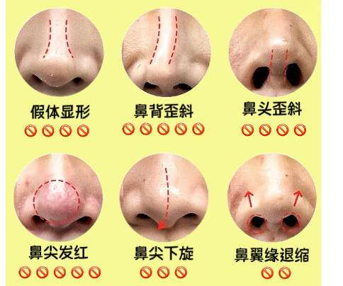 鼻修复2.jpg 鼻修复2.jpg