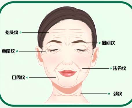 除皱