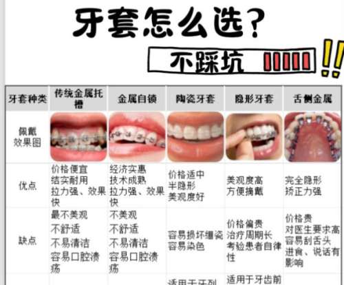 牙齿矫正