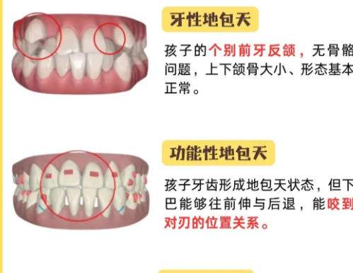 牙齿矫正5.jpg