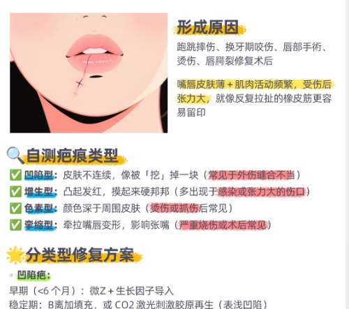 疤痕修复 疤痕修复