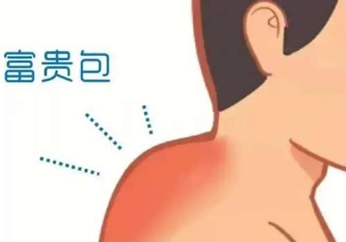 富贵包2.jpg