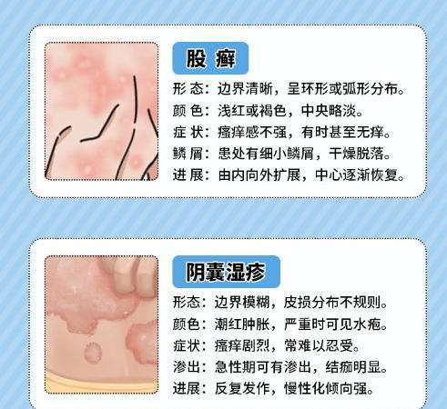 男性私密.jpg