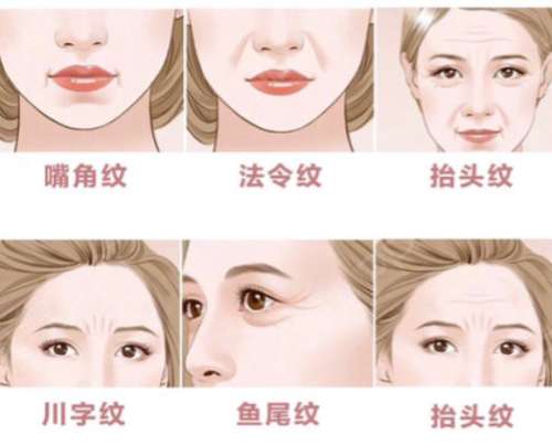 川字纹