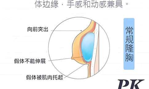 丰胸5.jpg 丰胸5.jpg