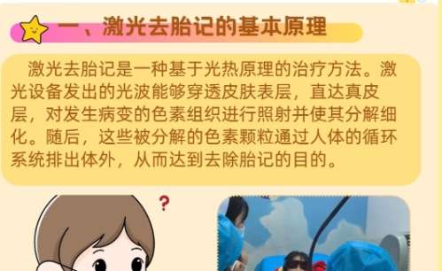 激光祛红黑胎记
