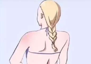 吸脂瘦后背动5.jpg 吸脂瘦后背动5.jpg