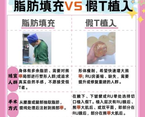 脂肪隆胸