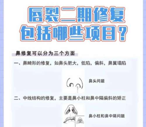 唇裂修复2.jpg