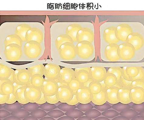 吸脂