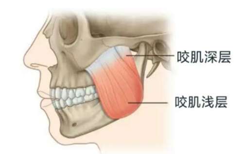 下颌角 下颌角