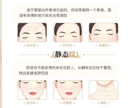 除皱
