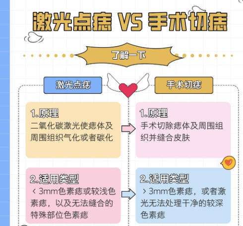 切痣.jpg