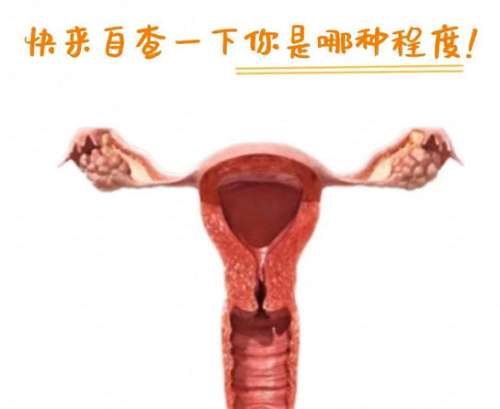 私密紧缩 私密紧缩
