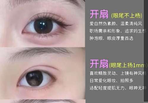 双眼皮 .jpg 双眼皮 .jpg