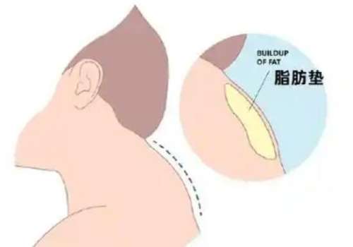富贵包