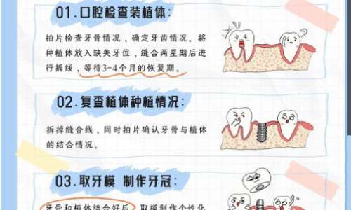 牙齿种植3.jpg
