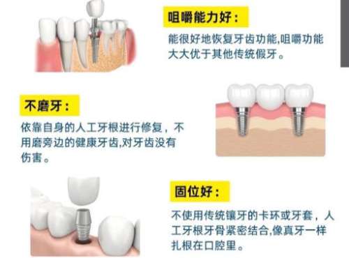 种牙6.jpg