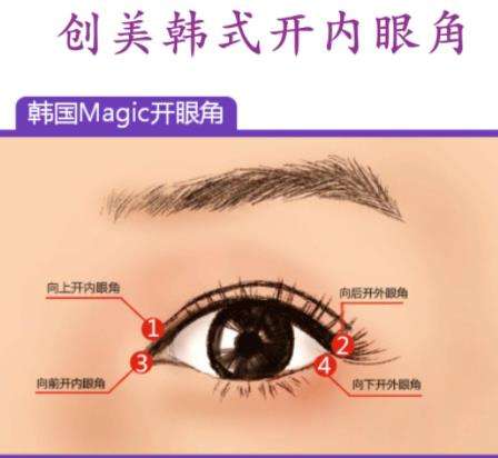 双眼皮01.jpg 双眼皮01.jpg