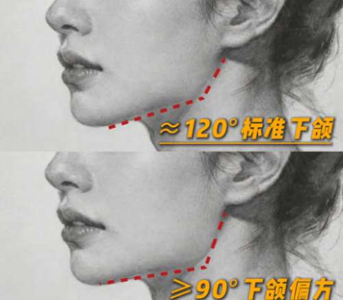 下颌角2.jpg 下颌角2.jpg