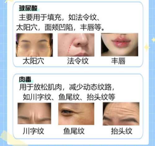 脸部注射.jpg