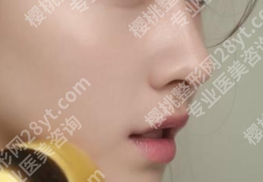 广州华美做鼻子哪位专家好？曾高医生实操鼻整形手术过程一览！