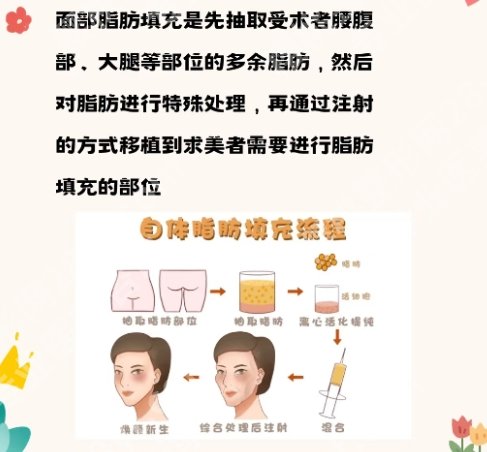 成都脂肪填充医生就诊医院相关介绍！快速就诊不踩坑！