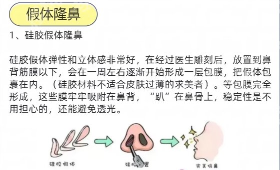 浙一做鼻子好的是谁？沈向前、范希玲、王守界等医生榜上有名！