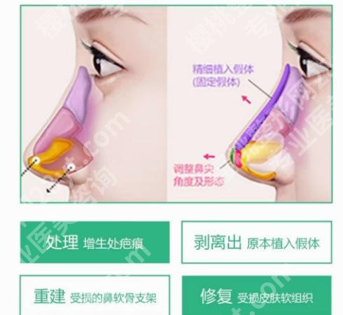 南昌鼻修复专家前十名公布!top10口碑推荐!