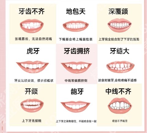珠海牙齿矫正哪个医院做的好?五家实力医院等你来看!