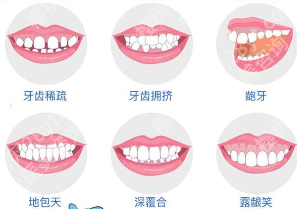 绍兴牙齿矫正便宜的医院名单新鲜出炉！一键了解实力医院