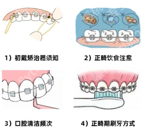 台州牙齿矫正医院排名榜单一览！市一院、市中心医院专业度高