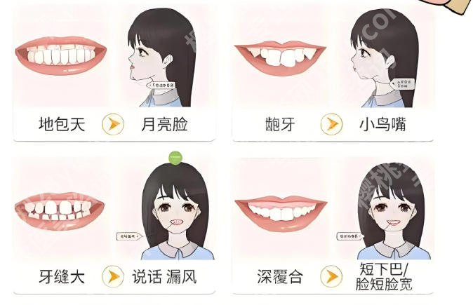 徐州牙齿正畸哪个医生好？陈亚刚/张静医生技术在线！