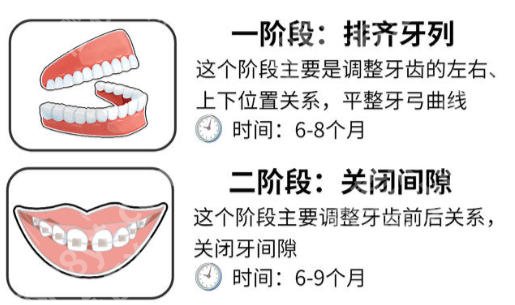 厦门牙齿矫正要多少钱？2026矫正价格趋势全解析！