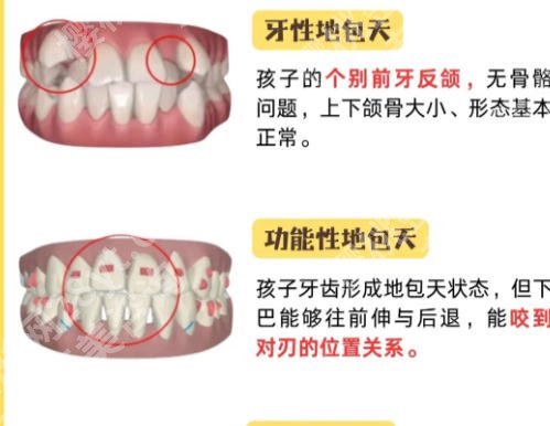 温州牙齿矫正哪里好？这几家医院技术在线、人气爆棚！