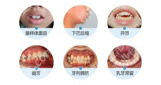 台州牙齿矫正医院推荐名单出炉！含各大医院基本资料