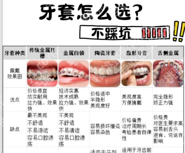 昆明牙齿矫正医院推荐名单一览！热门机构等你来选！