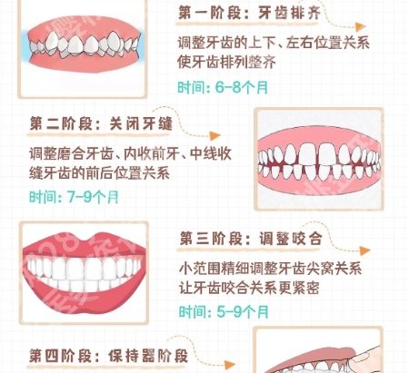 沈阳牙齿矫正哪家好?一键查看这五家医院实力