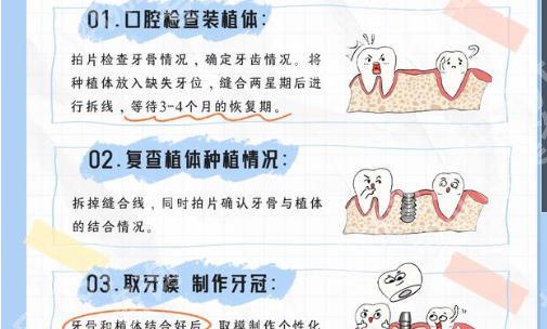 丽水种植牙口腔医院排名前十揭晓!这些医院个个实力派口碑技艺俱佳!