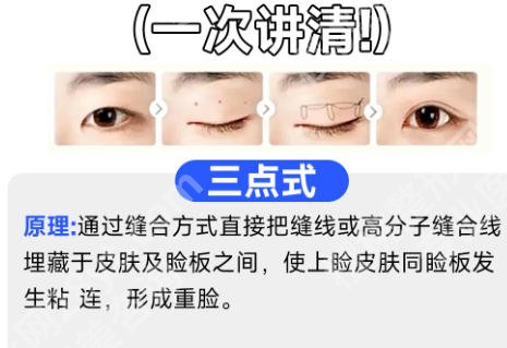 北京王博谦医生详细介绍揭晓！含面诊小技巧及面诊攻略分享！