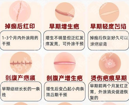 杨志强整形医生的个人资料及简介图片公示！附真实案例分享！