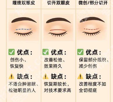石海山医生口碑评价如何？做双眼皮技术超牛！含2026全新价格