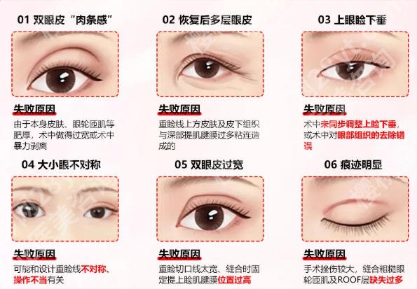 卢燕明手术技术怎么样?技术口碑值得信赖！戳进来看