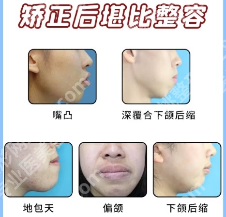 南昌牙齿矫正哪里好？医院名单发布！避坑指南看这里