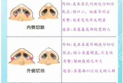 连凯峰隆鼻怎么样？坐诊医院及26年价格表曝光！