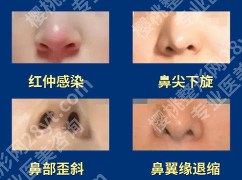 龙鹏辉医生优势怎么样?含医生详细介绍及真实口碑点评来袭!