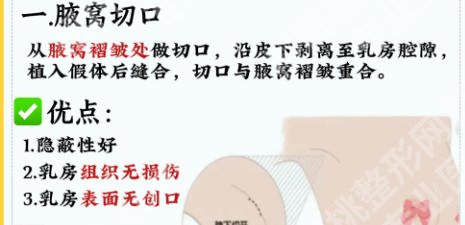 沈正宇医生口碑怎么样?医生简介、擅长项目及坐诊医院介绍!