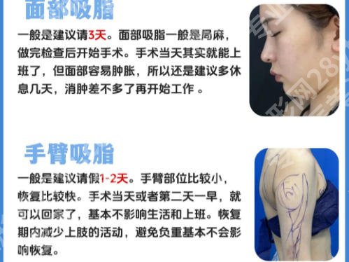 咸阳打瘦脸哪里比较好?网友力荐榜单揭晓!
