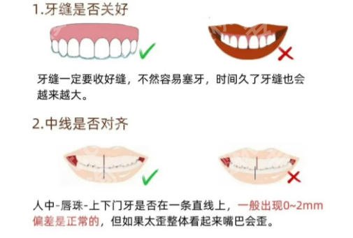 徐州牙齿矫正多少钱价位的？2026正规牙科医院矫正牙收费价目表