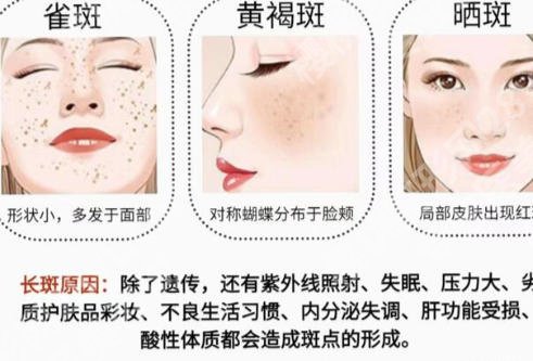 邵阳市哪家医院祛斑好?这几家医院实力不俗快来看!